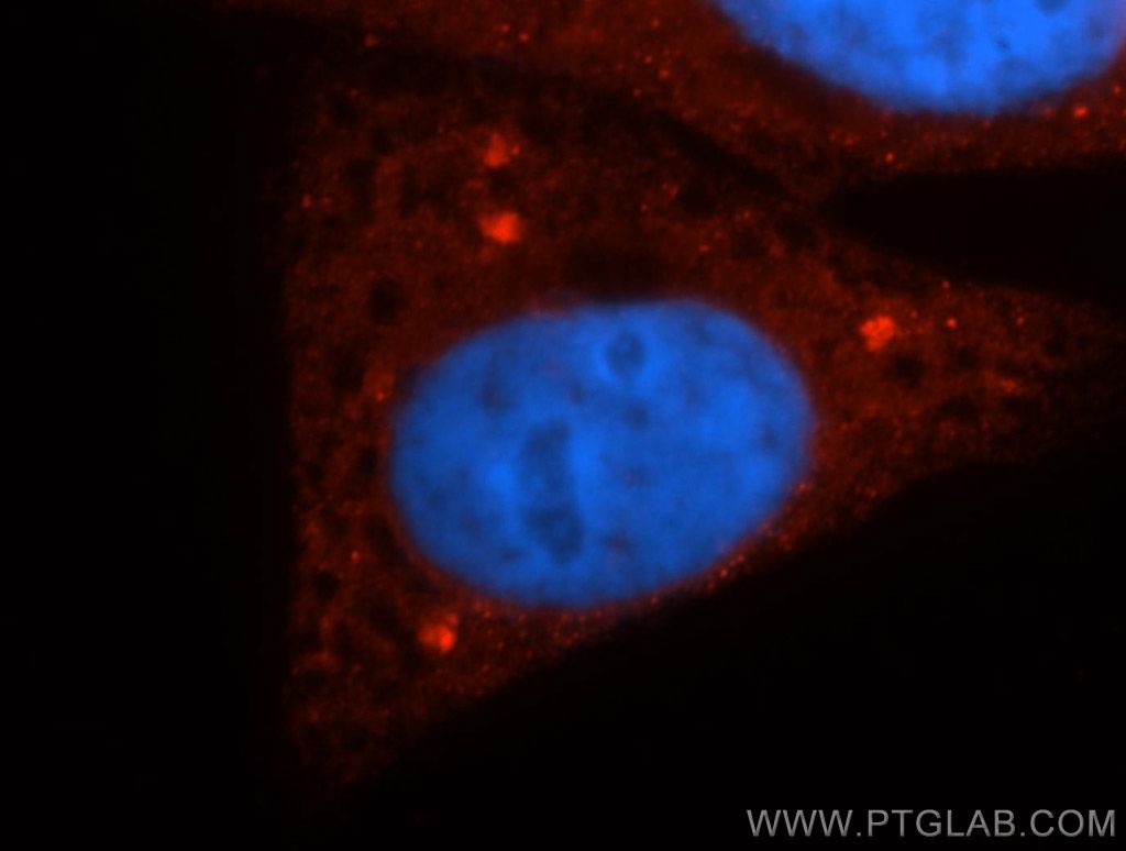 Immunofluorescence (IF) / fluorescent staining of HepG2 cells using Casein Kinase 1 Delta Polyclonal antibody (14388-1-AP)