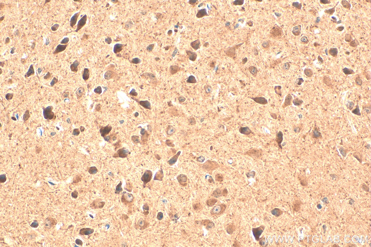 Immunohistochemistry (IHC) staining of mouse brain tissue using Casein Kinase 1 Delta Polyclonal antibody (14388-1-AP)