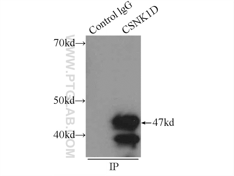 Immunoprecipitation (IP) experiment of HeLa cells using Casein Kinase 1 Delta Polyclonal antibody (14388-1-AP)