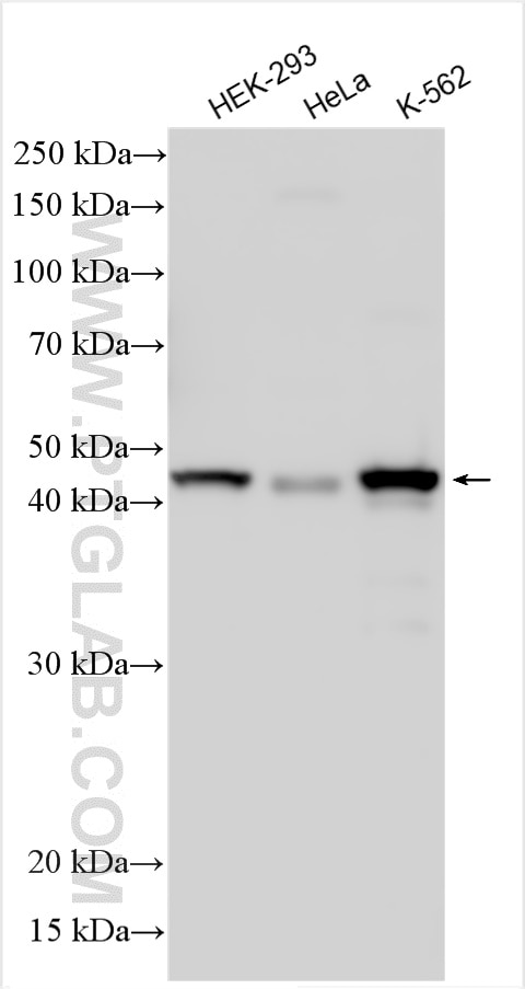 Western Blot (WB) analysis of various lysates using Casein Kinase 1 Delta Polyclonal antibody (14388-1-AP)