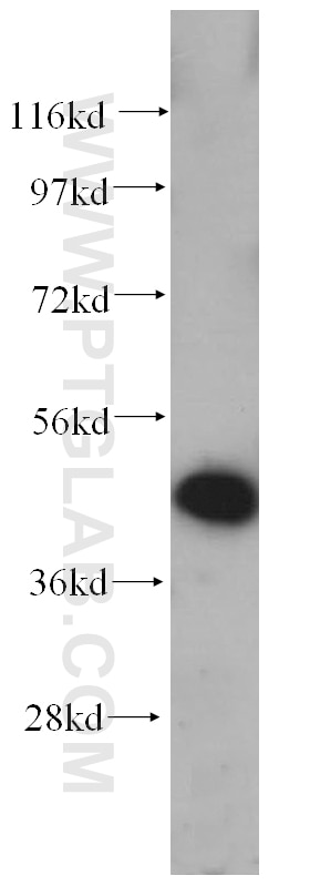Western Blot (WB) analysis of HeLa cells using Casein Kinase 1 Delta Polyclonal antibody (14388-1-AP)