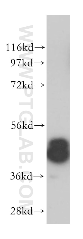 Western Blot (WB) analysis of K-562 cells using Casein Kinase 1 Delta Polyclonal antibody (14388-1-AP)