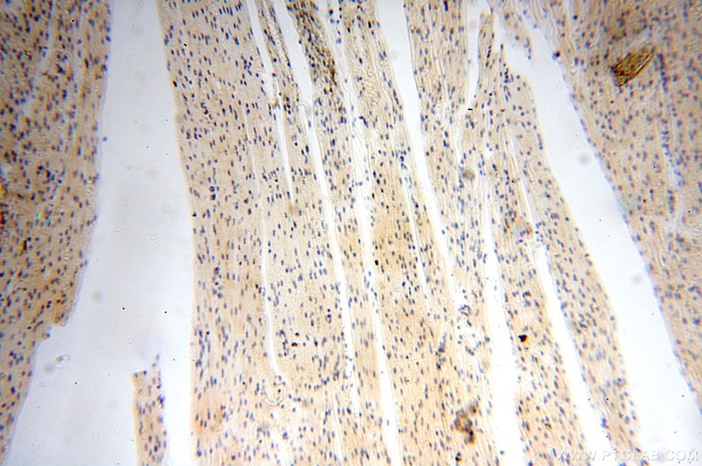 Immunohistochemistry (IHC) staining of human heart tissue using Casein Kinase 1 Epsilon Polyclonal antibody (11230-1-AP)