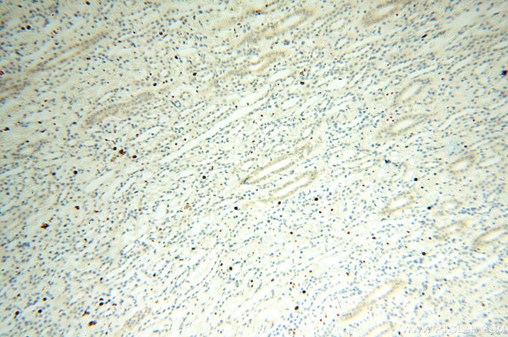 Immunohistochemistry (IHC) staining of human kidney tissue using Casein Kinase 1 Epsilon Polyclonal antibody (11230-1-AP)