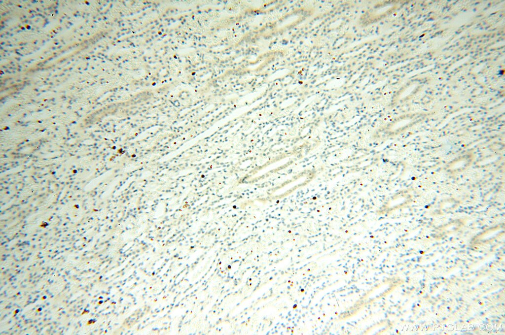 Immunohistochemistry (IHC) staining of human kidney tissue using Casein Kinase 1 Epsilon Polyclonal antibody (11230-1-AP)