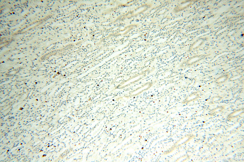 Immunohistochemistry (IHC) staining of human kidney tissue using Casein Kinase 1 Epsilon Polyclonal antibody (11230-1-AP)