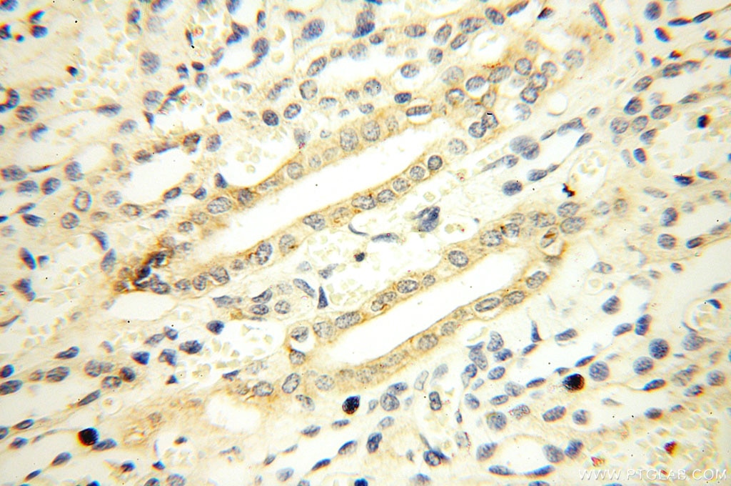 Immunohistochemistry (IHC) staining of human kidney tissue using Casein Kinase 1 Epsilon Polyclonal antibody (11230-1-AP)