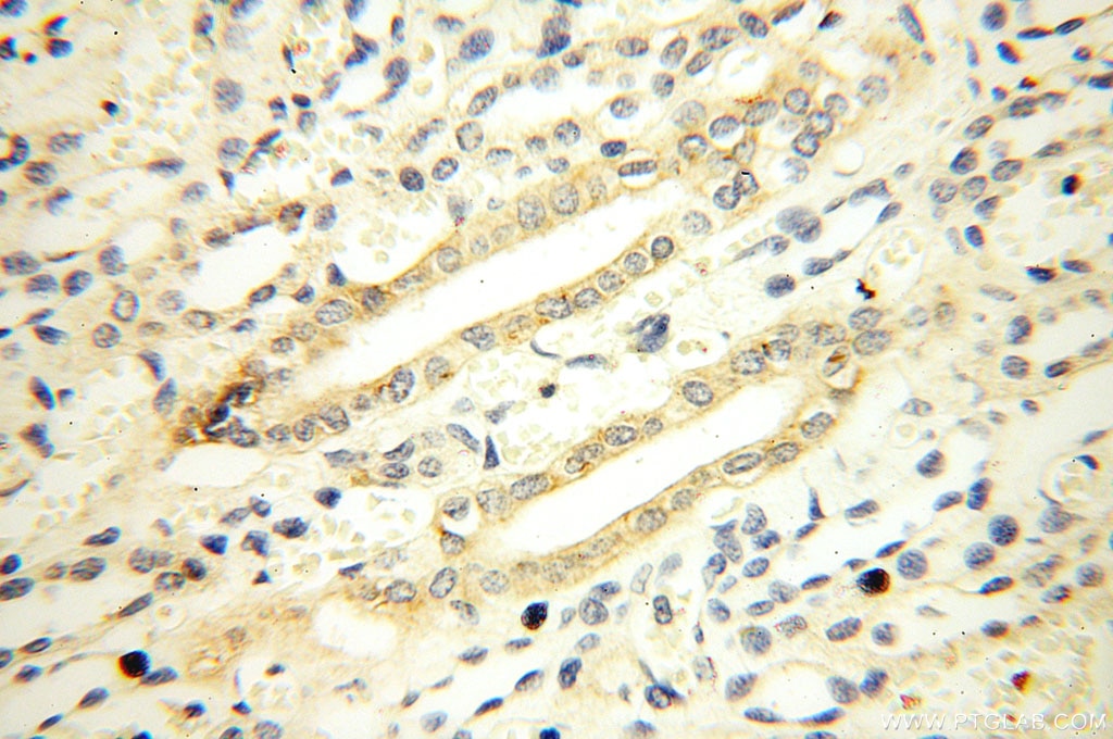 Immunohistochemistry (IHC) staining of human kidney tissue using Casein Kinase 1 Epsilon Polyclonal antibody (11230-1-AP)