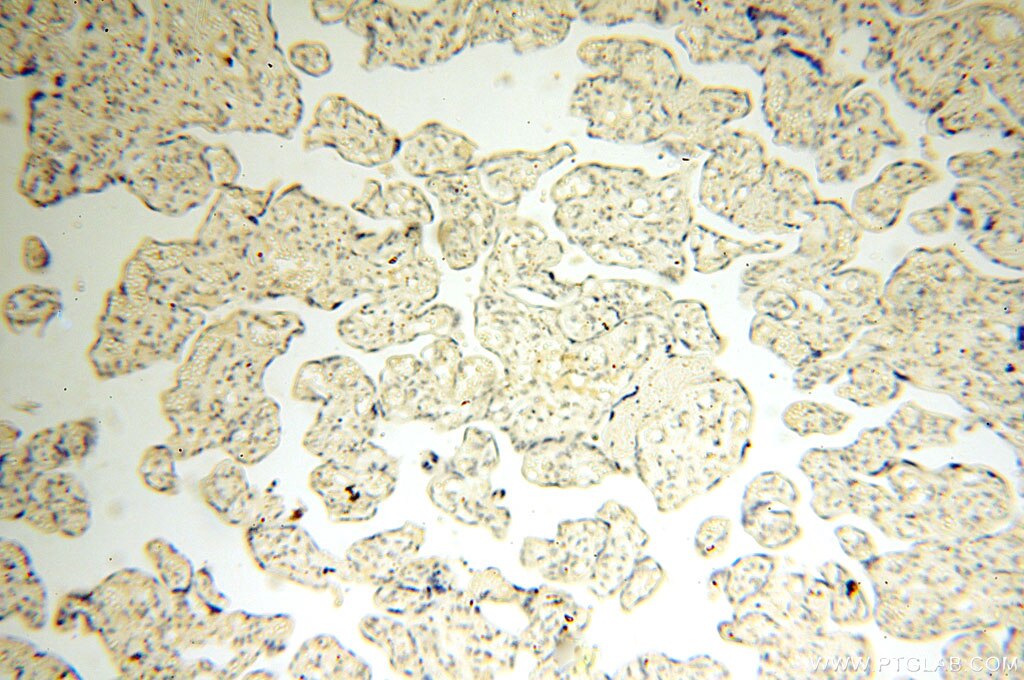 Casein Kinase 1 Epsilon