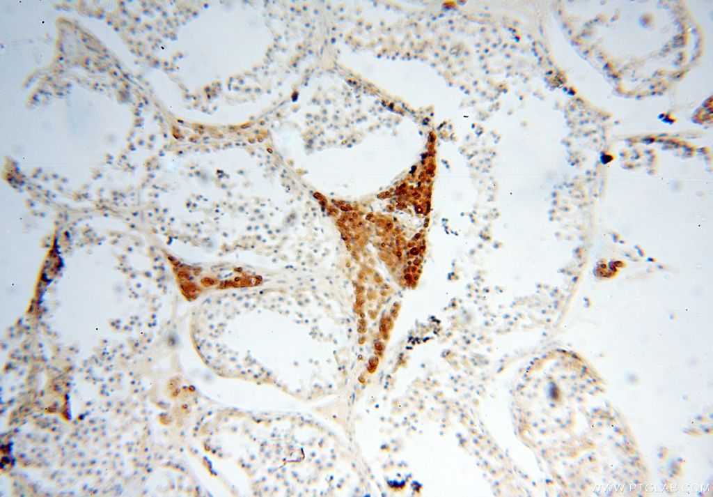Immunohistochemistry (IHC) staining of human testis tissue using Casein Kinase 1 Epsilon Polyclonal antibody (11230-1-AP)