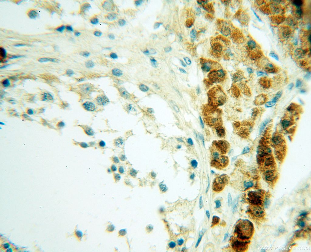 Immunohistochemistry (IHC) staining of human testis tissue using Casein Kinase 1 Epsilon Polyclonal antibody (11230-1-AP)