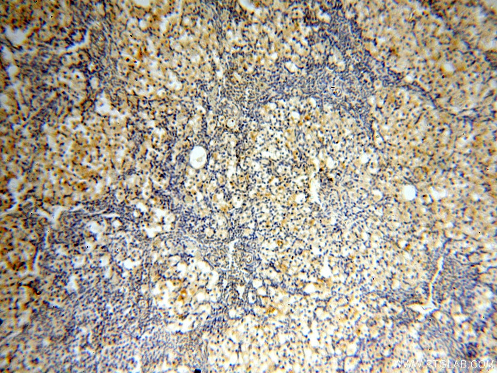 Immunohistochemistry (IHC) staining of human ovary tissue using Casein Kinase 1 Epsilon Polyclonal antibody (11230-1-AP)