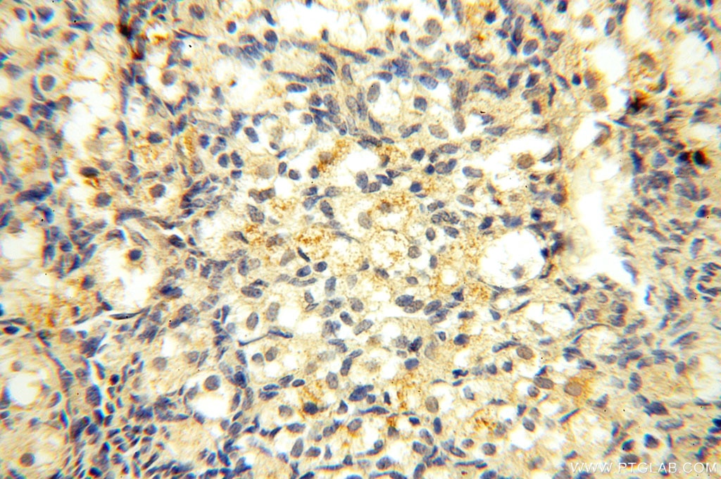Immunohistochemistry (IHC) staining of human ovary tissue using Casein Kinase 1 Epsilon Polyclonal antibody (11230-1-AP)