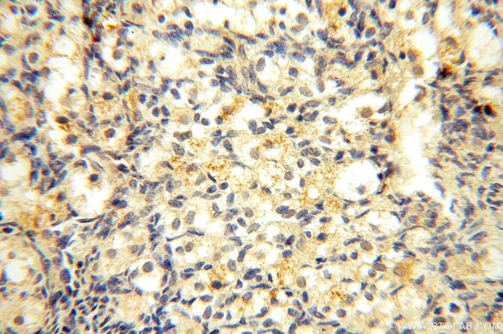 IHC staining of human ovary using 11230-1-AP