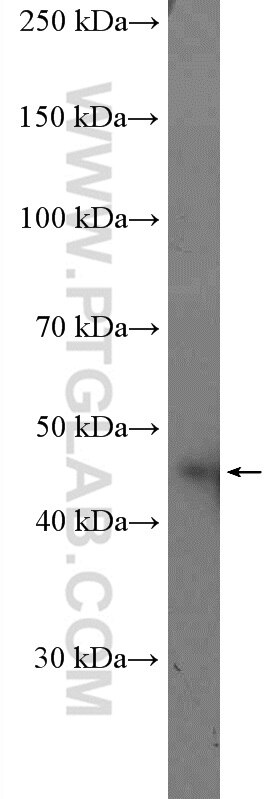 Western Blot (WB) analysis of mouse brain tissue using Casein Kinase 1 Epsilon Polyclonal antibody (11230-1-AP)