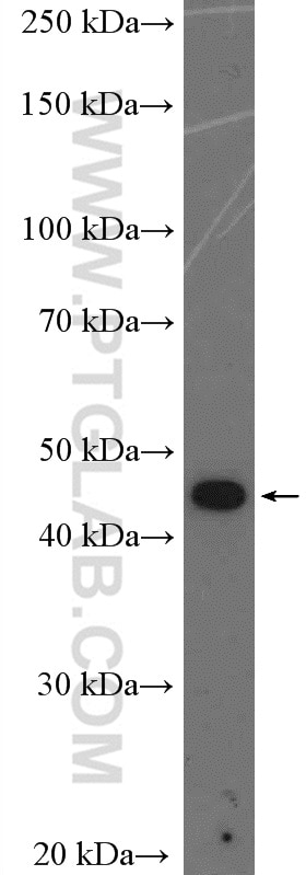 Western Blot (WB) analysis of A431 cells using Casein Kinase 1 Epsilon Polyclonal antibody (11230-1-AP)