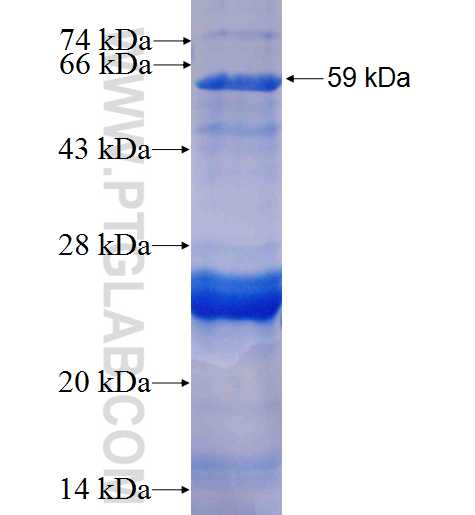 CSNK1E fusion protein Ag1742 SDS-PAGE