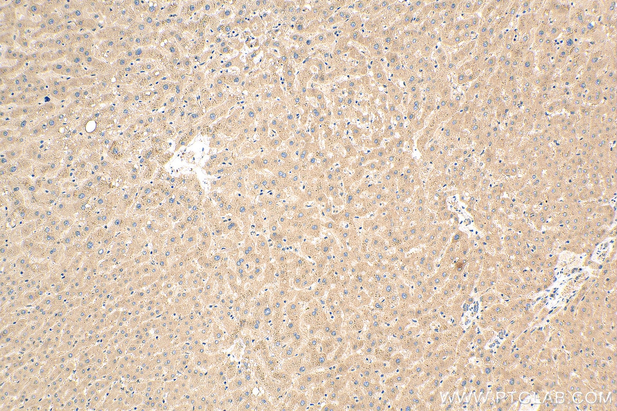 Immunohistochemistry (IHC) staining of human liver tissue using CSNK1G1 Polyclonal antibody (16384-1-AP)