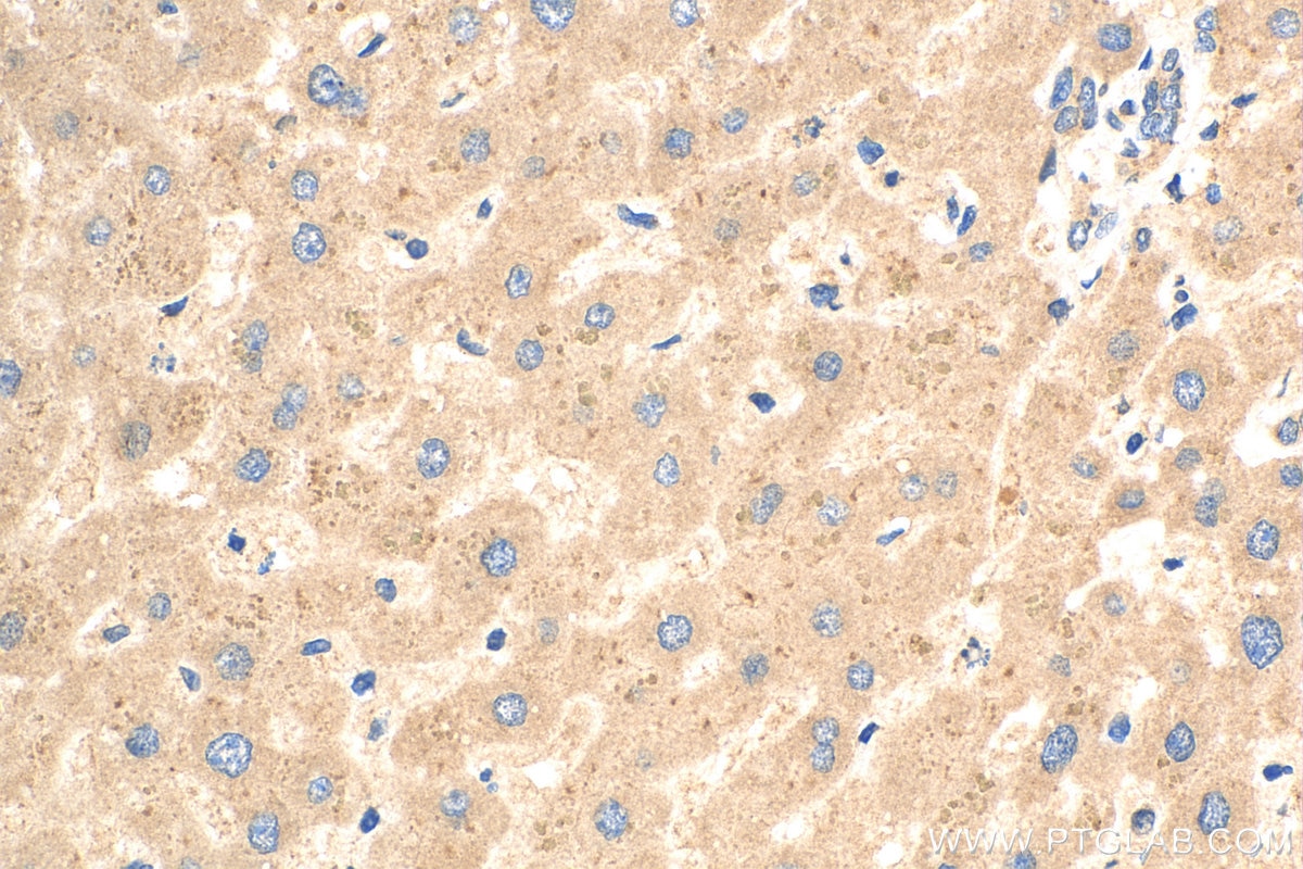 Immunohistochemistry (IHC) staining of human liver tissue using CSNK1G1 Polyclonal antibody (16384-1-AP)