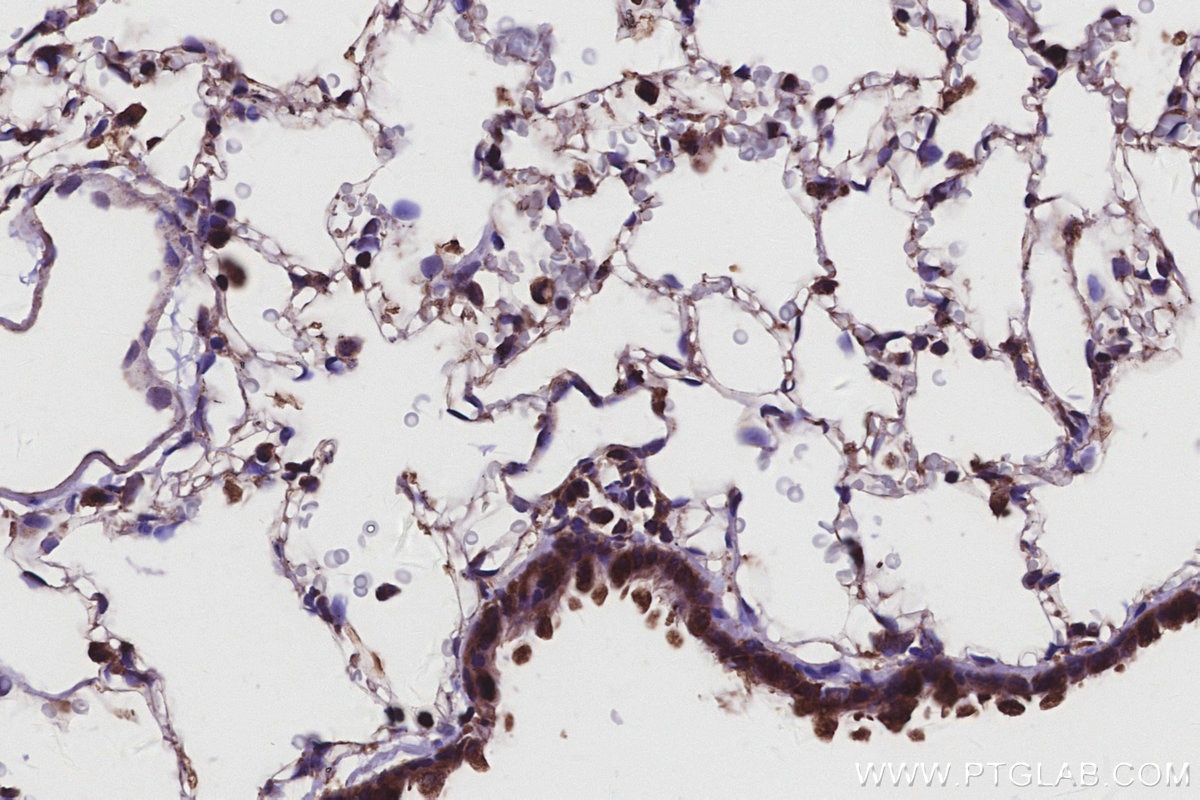 IHC staining of rat lung using 16384-1-AP Immunohistochemistry (IHC) staining of rat lung tissue using CSNK1G1 Polyclonal antibody (16384-1-AP)