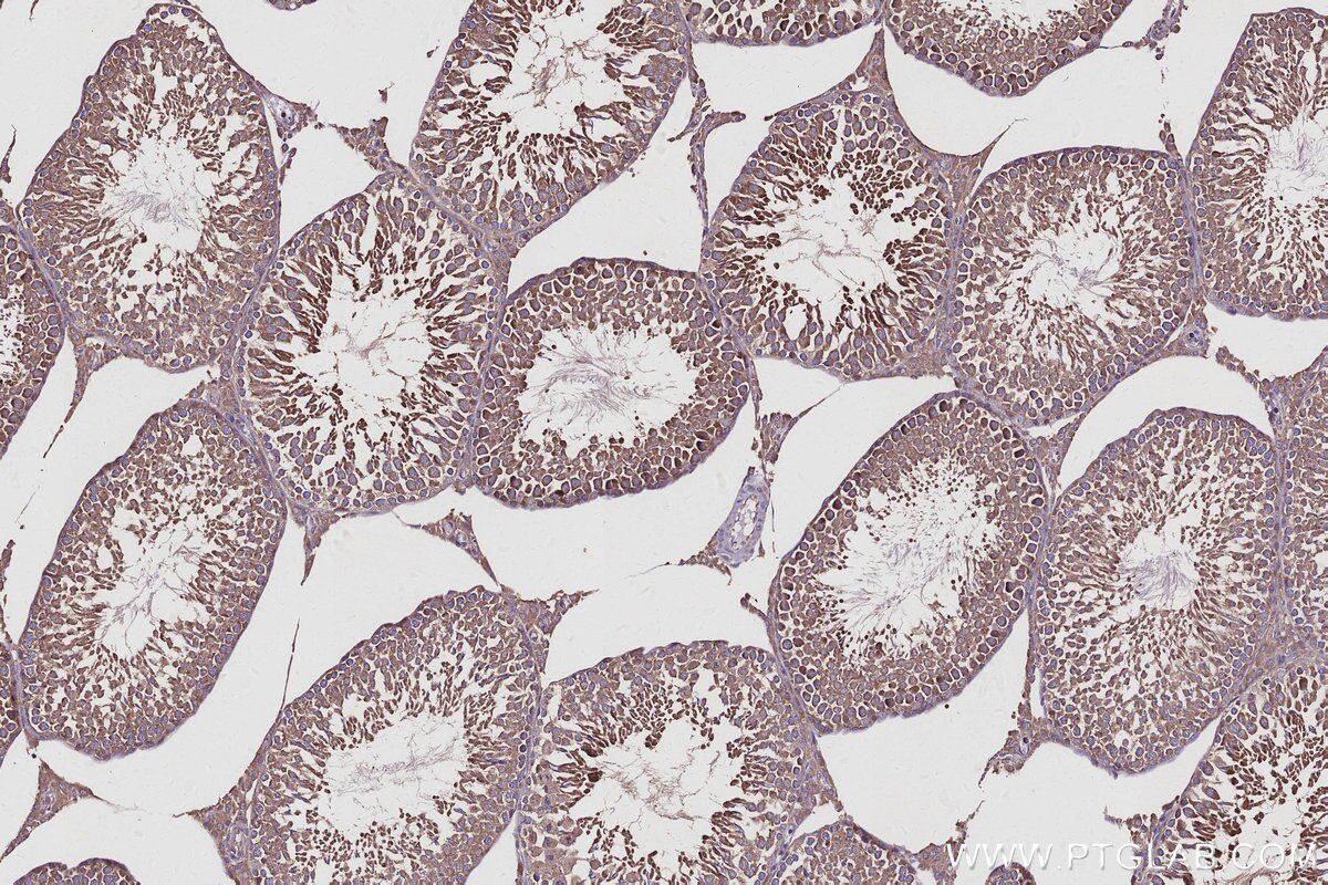 IHC staining of rat testis using 16384-1-AP Immunohistochemistry (IHC) staining of rat testis tissue using CSNK1G1 Polyclonal antibody (16384-1-AP)