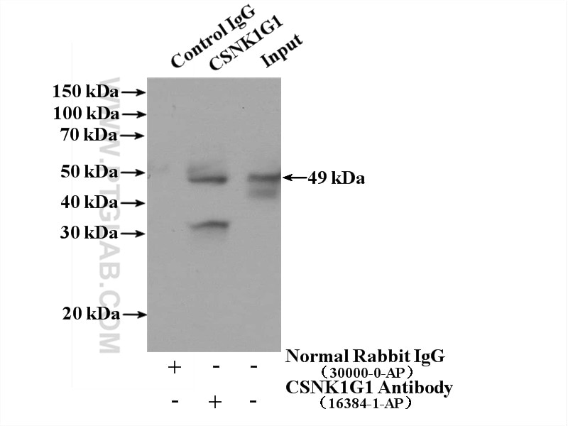 Immunoprecipitation (IP) experiment of Jurkat cells using CSNK1G1 Polyclonal antibody (16384-1-AP)