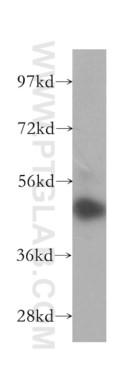 Western Blot (WB) analysis of Jurkat cells using CSNK1G1 Polyclonal antibody (16384-1-AP)