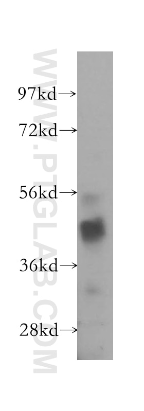 Western Blot (WB) analysis of COS-7 cells using CSNK1G1 Polyclonal antibody (16384-1-AP)
