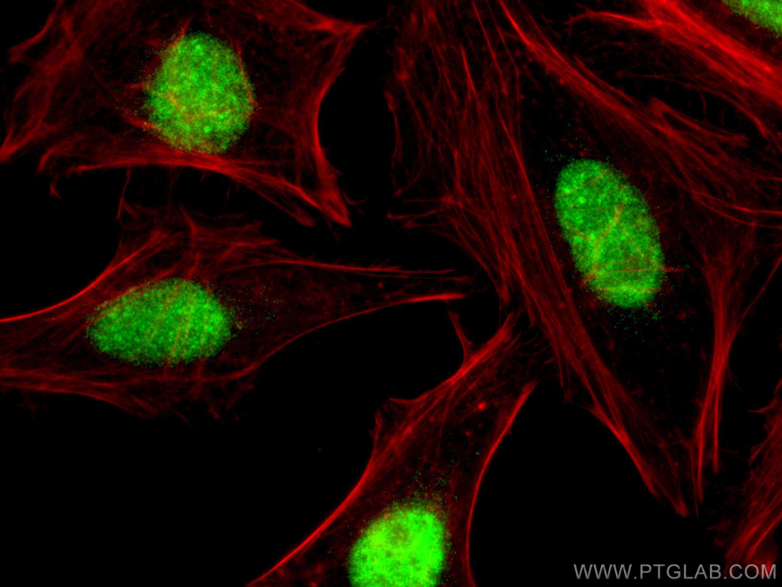 Immunofluorescence (IF) / fluorescent staining of HeLa cells using CSNK2A1 Polyclonal antibody (10992-1-AP)