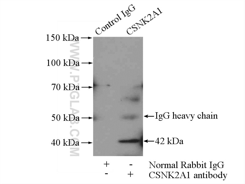 Immunoprecipitation (IP) experiment of HeLa cells using CSNK2A1 Polyclonal antibody (10992-1-AP)