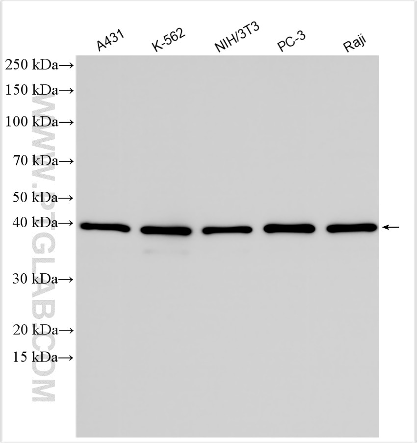 Western Blot (WB) analysis of various lysates using CSNK2A1 Polyclonal antibody (10992-1-AP)