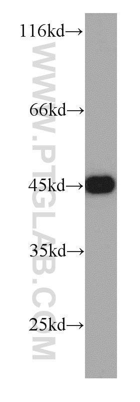 CSNK2A1 Polyclonal antibody