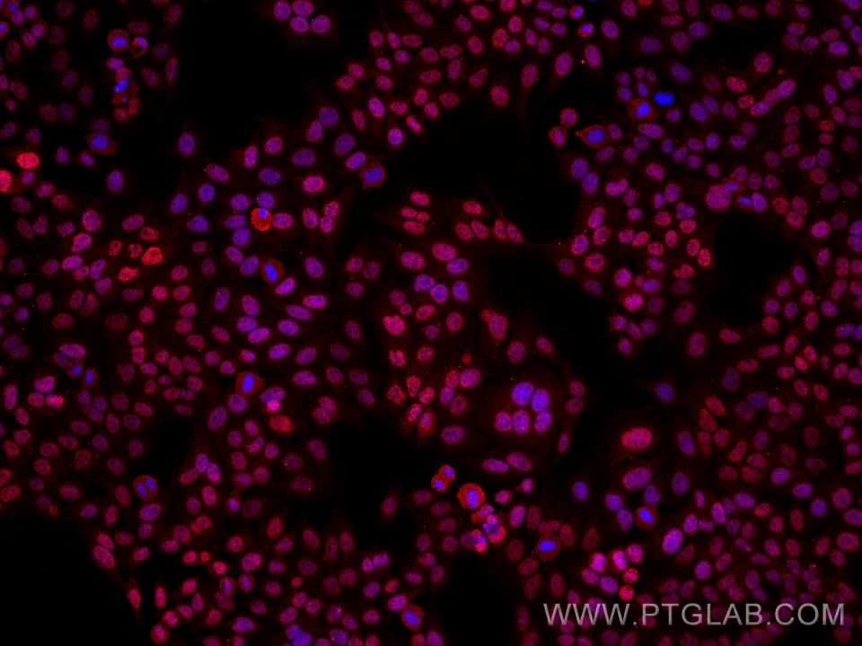 Immunofluorescence (IF) / fluorescent staining of HepG2 cells using CSNK2A1 Monoclonal antibody (68200-1-Ig)