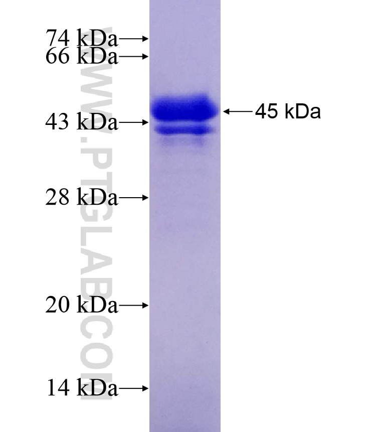 CSNK2A1 fusion protein Ag29062 SDS-PAGE