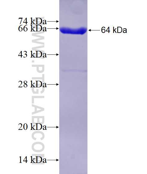 CSNK2A1 fusion protein Ag1452 SDS-PAGE