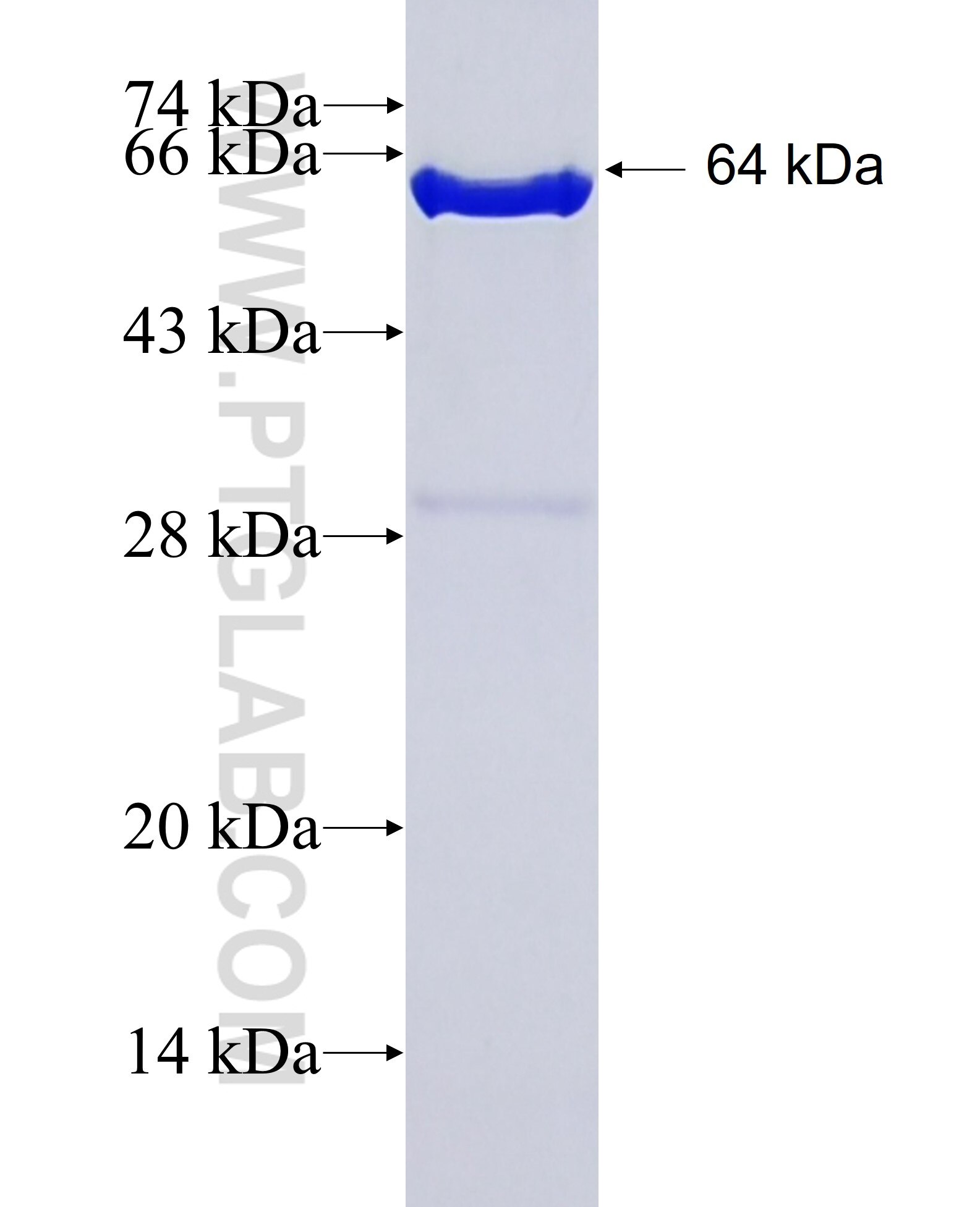 CSNK2A1 fusion protein Ag1452 SDS-PAGE