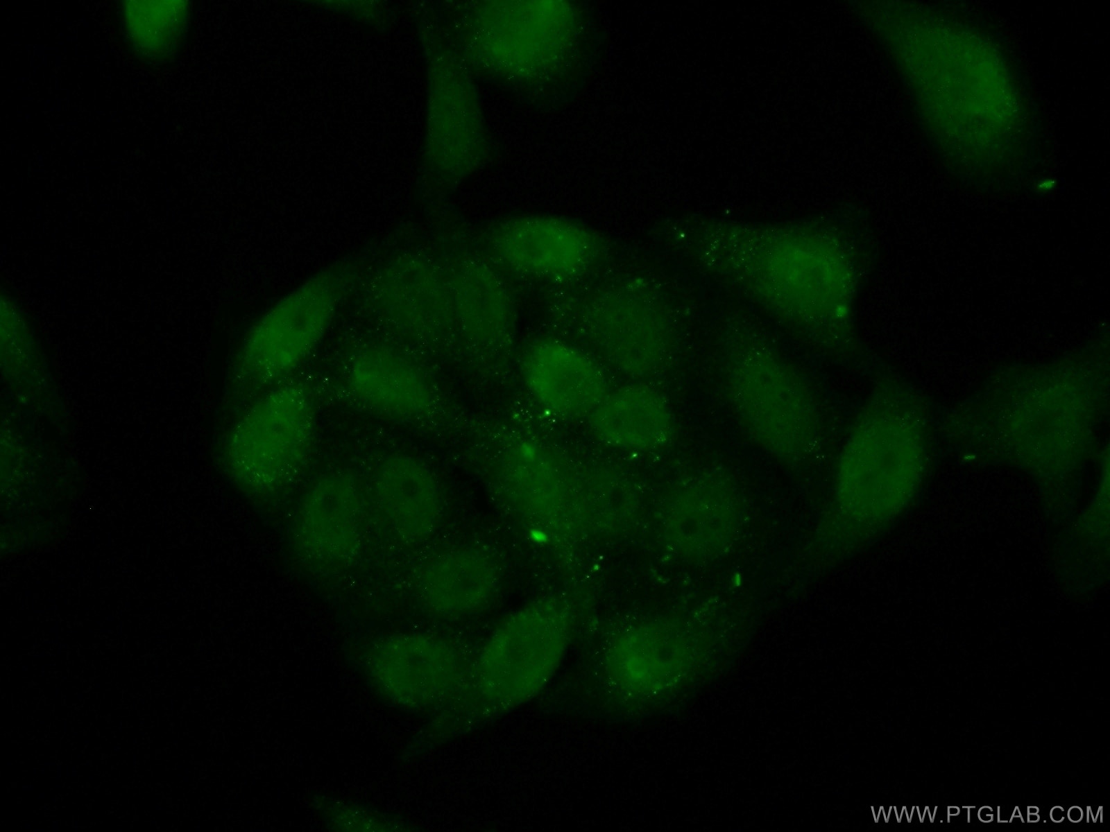 Immunofluorescence (IF) / fluorescent staining of HepG2 cells using CSNK2A2 Polyclonal antibody (10606-1-AP)