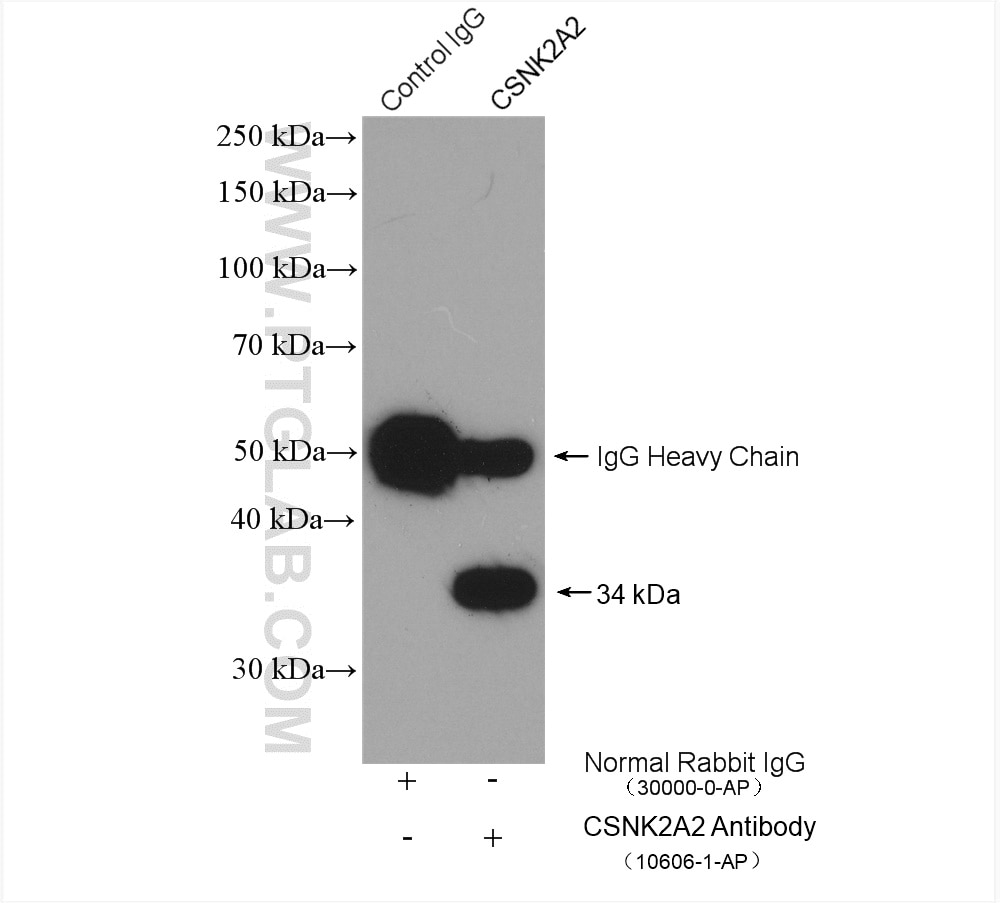 Immunoprecipitation (IP) experiment of Jurkat cells using CSNK2A2 Polyclonal antibody (10606-1-AP)
