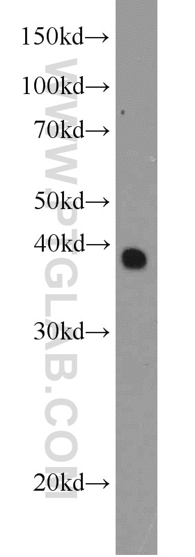 Western Blot (WB) analysis of HT-1080 cells using CSNK2A2 Polyclonal antibody (10606-1-AP)