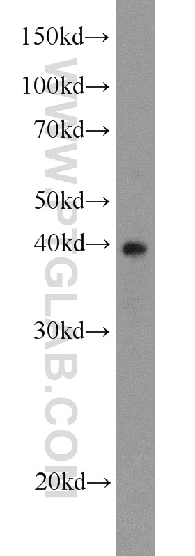 Western Blot (WB) analysis of Jurkat cells using CSNK2A2 Polyclonal antibody (10606-1-AP)