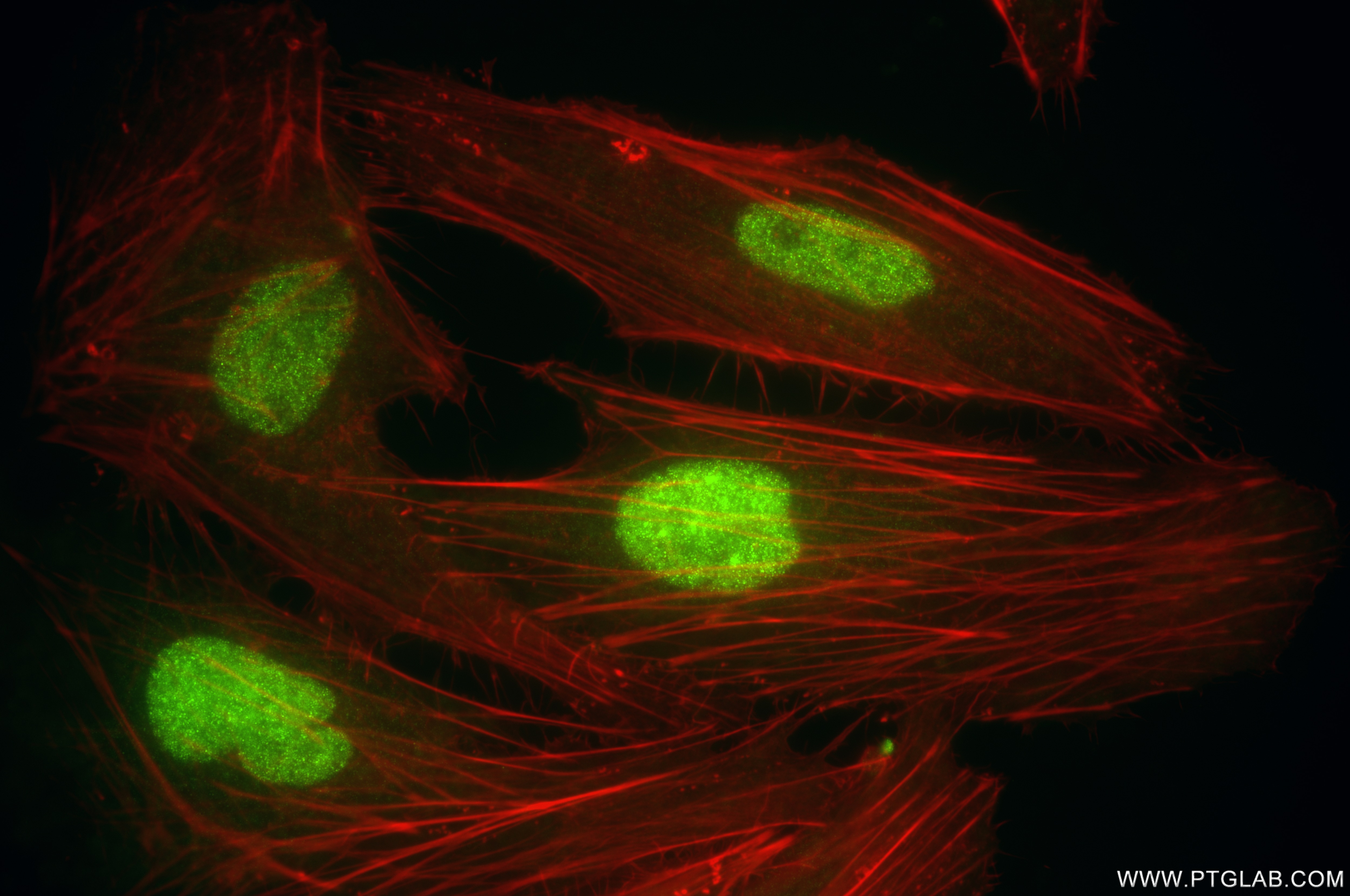 Immunofluorescence (IF) / fluorescent staining of HeLa cells using CSNK2A2 Recombinant antibody (86169-2-RR)