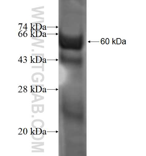 CSNK2A2 fusion protein Ag0877 SDS-PAGE