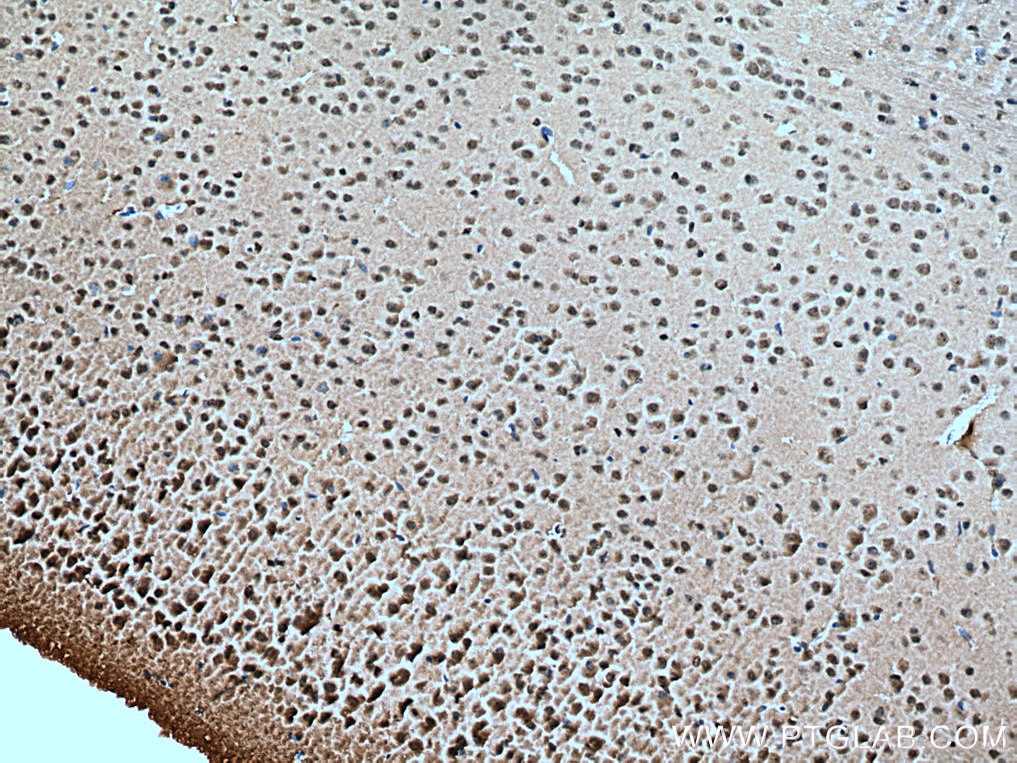Immunohistochemistry (IHC) staining of mouse brain tissue using CSNK2B Polyclonal antibody (22418-1-AP)