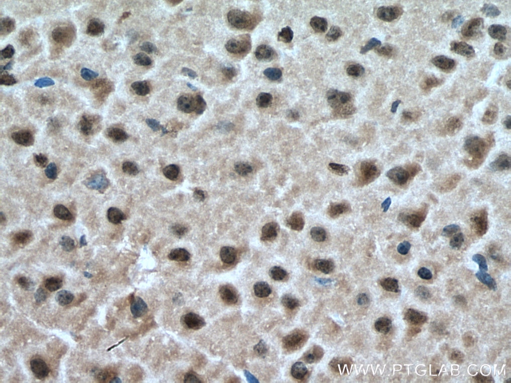 Immunohistochemistry (IHC) staining of mouse brain tissue using CSNK2B Polyclonal antibody (22418-1-AP)
