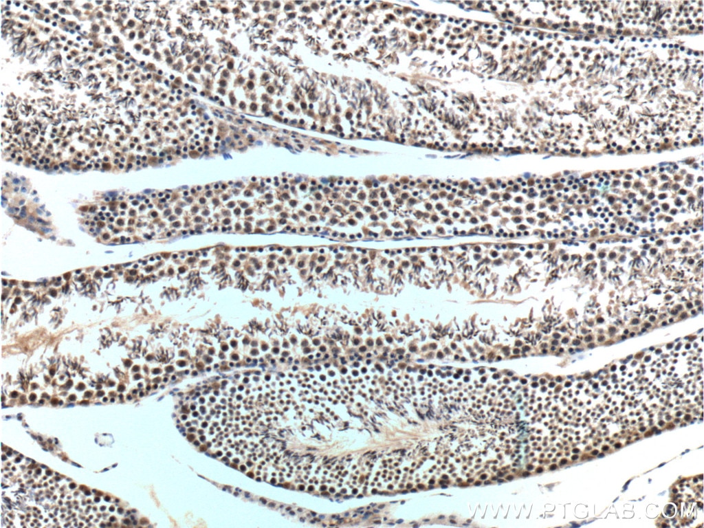 IHC staining of mouse testis using 22418-1-AP