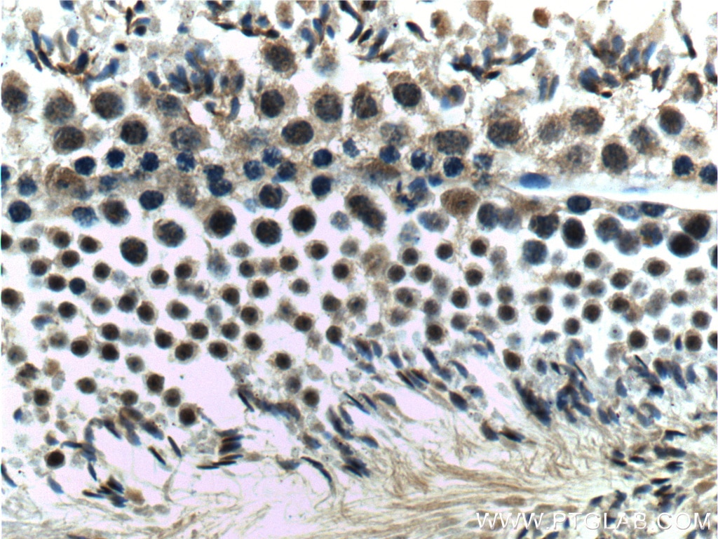 Immunohistochemistry (IHC) staining of mouse testis tissue using CSNK2B Polyclonal antibody (22418-1-AP)