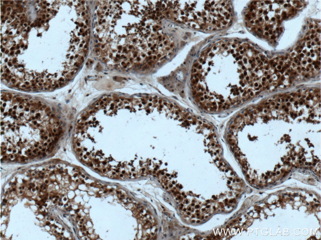 Immunohistochemistry (IHC) staining of human testis tissue using CSNK2B Polyclonal antibody (22418-1-AP)