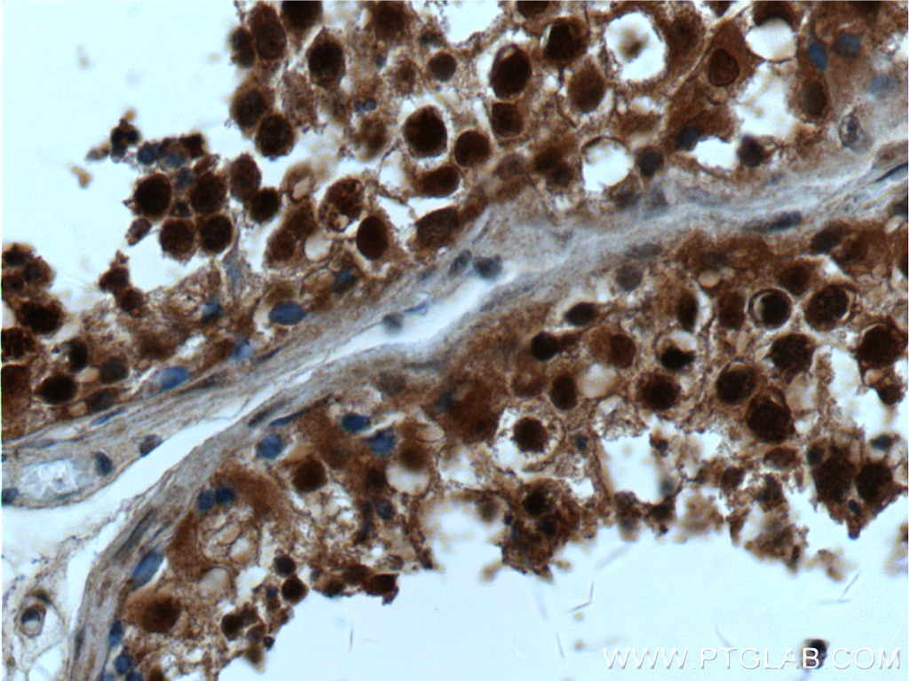 Immunohistochemistry (IHC) staining of human testis tissue using CSNK2B Polyclonal antibody (22418-1-AP)