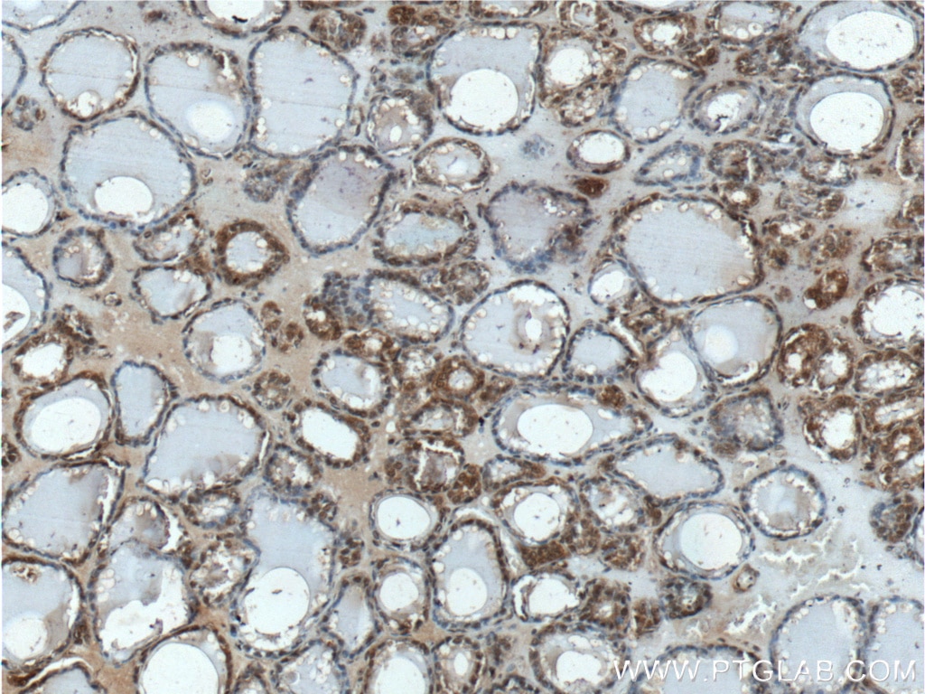 Immunohistochemistry (IHC) staining of human thyroid tissue using CSNK2B Polyclonal antibody (22418-1-AP)
