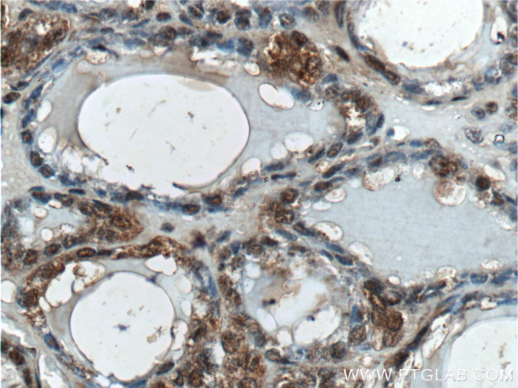 IHC staining of human thyroid using 22418-1-AP